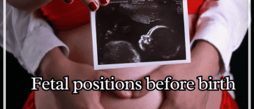 fetal positions before birth